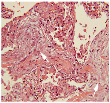 f03-fig2