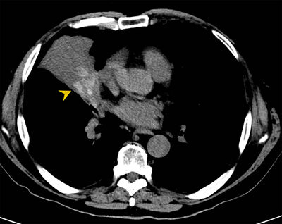 F03-fig10a