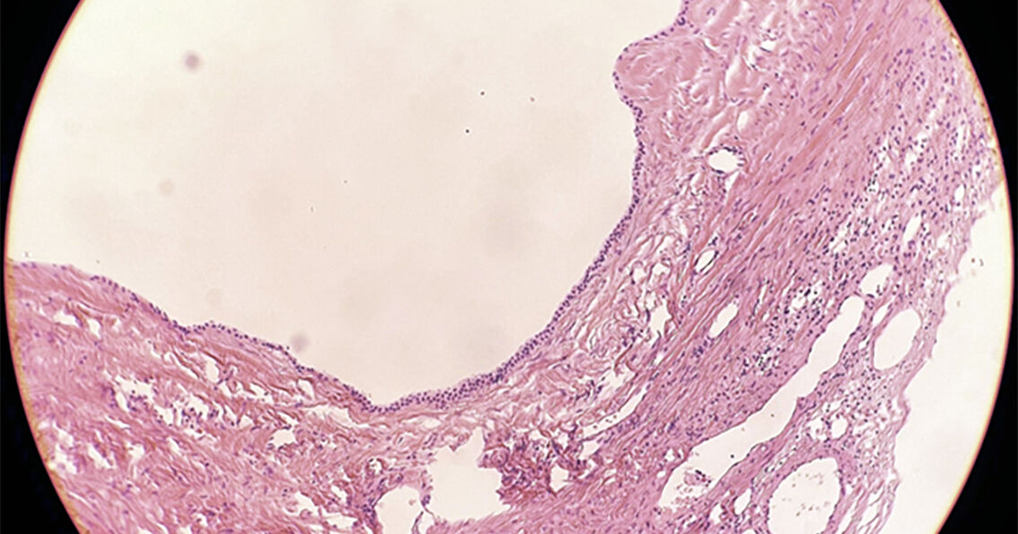 Qalin xoroz bilan etuk anal