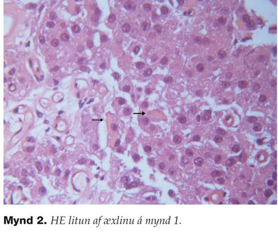 f04-fig2