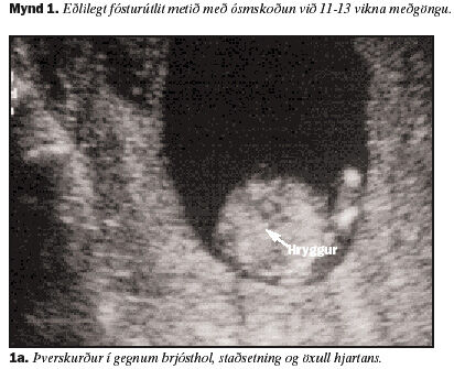 Ayollarni sikayotgan pornografik erkaklar suratlari Bir yigit semiz rus xotinini sikibdi