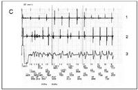 Figure C