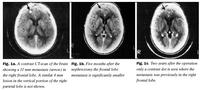 Fig. 1a-c