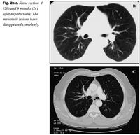 Fig. 2b-c